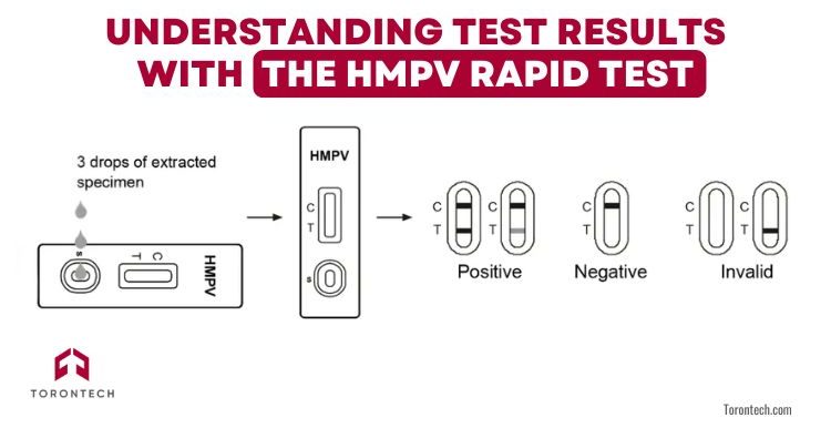 Understanding Test Results with the HMPV Rapid Test